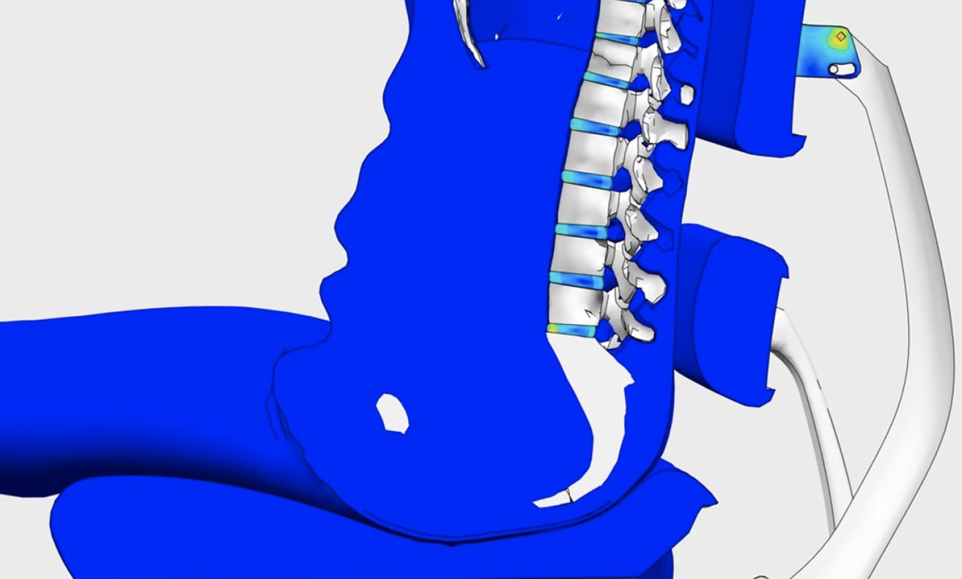 anthros-blue-spine-img1-2