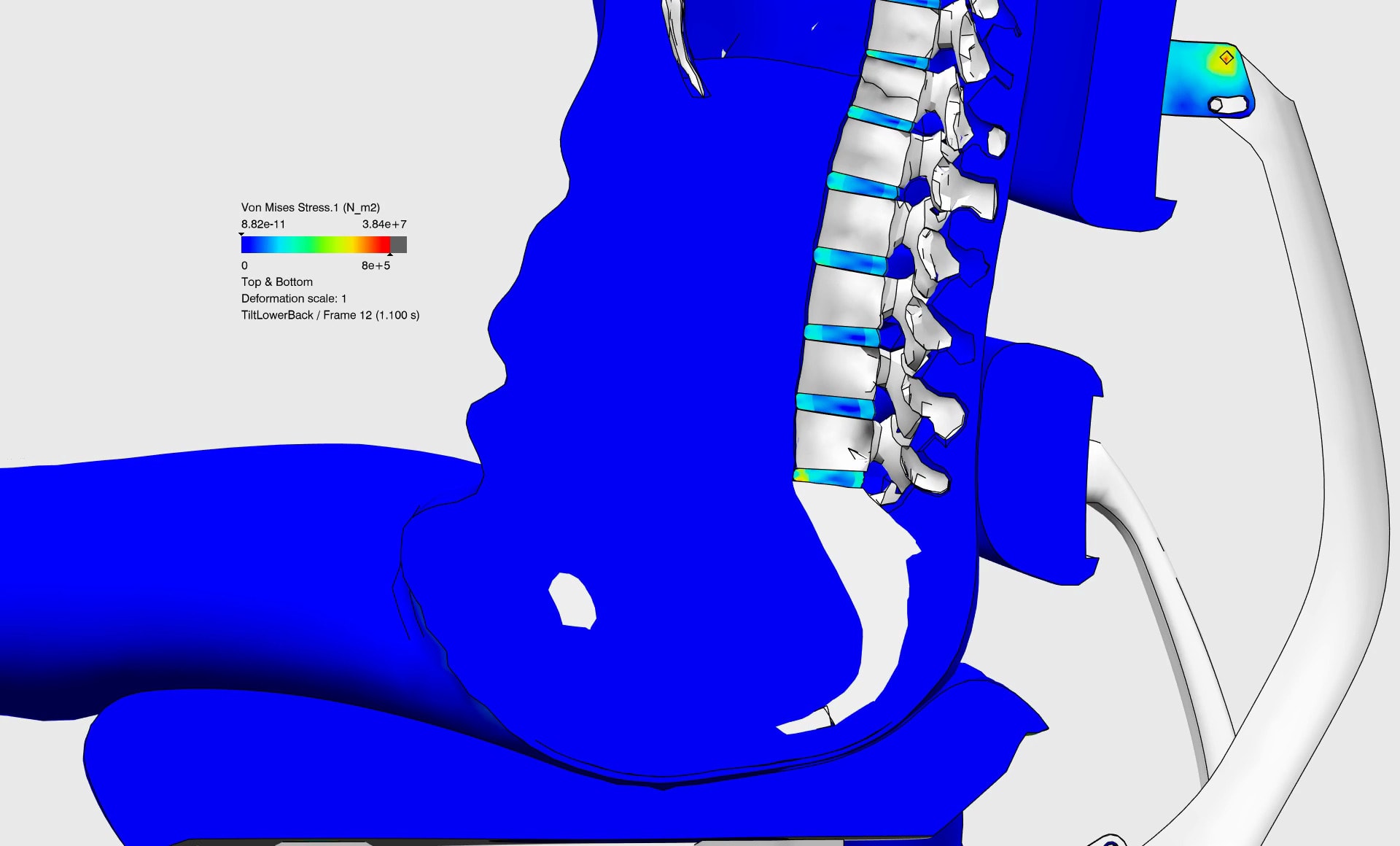 Preview image for Sitting Simulation: Using 3D Human Modeling