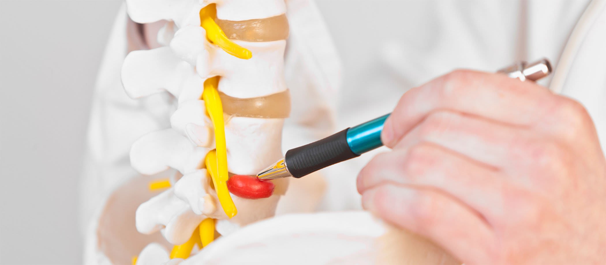 Preview image for How to Prevent Herniated Discs