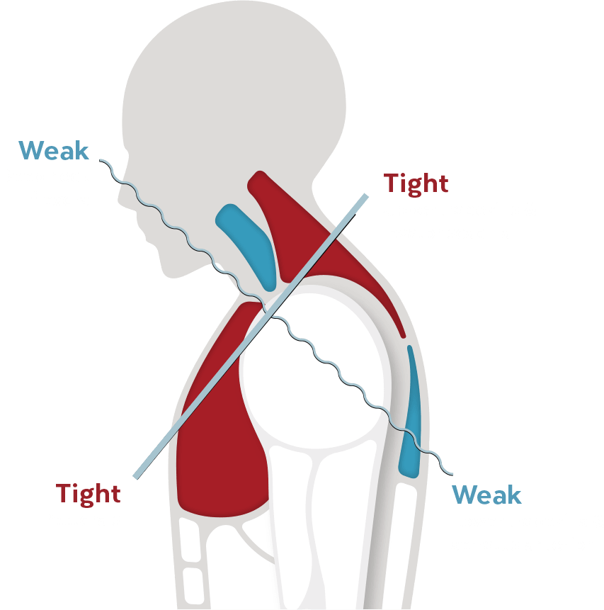 img_neck_sholuder-pain