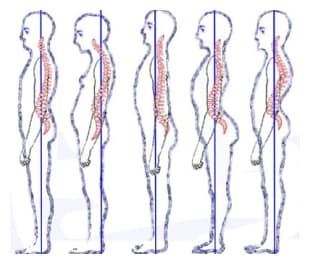 mid-back-pain-mobile-img-img-2