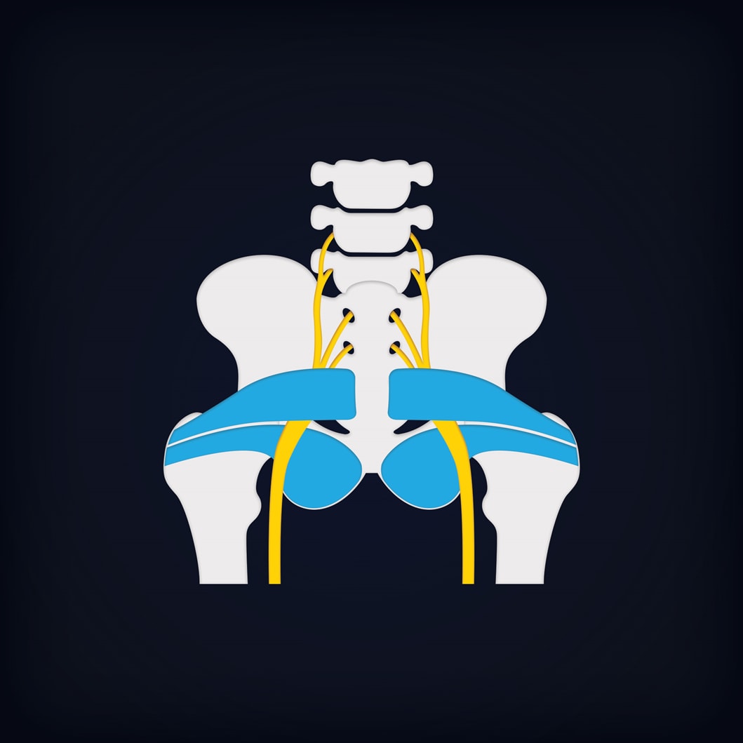 piriformis-syndrome-img