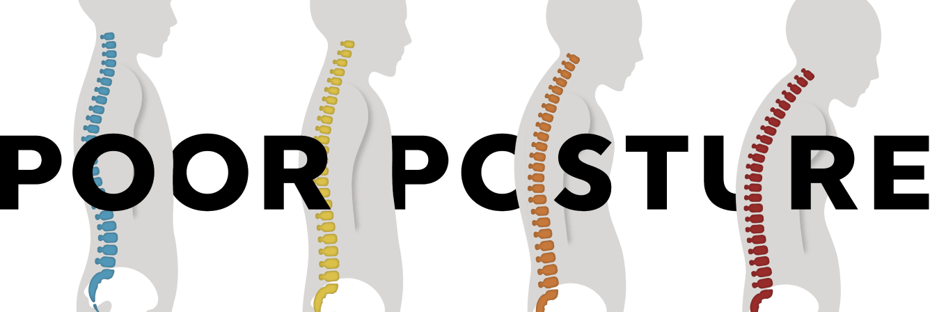 poor-posture-img