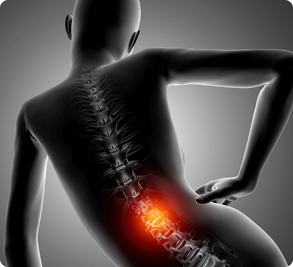 sciatica-lower-back