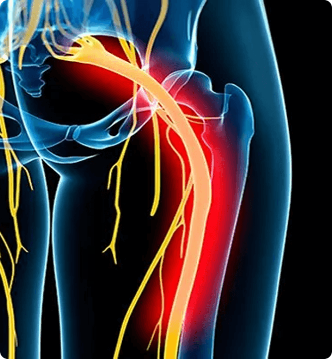 sit-without-sciatica-pain-feature-thumb-1