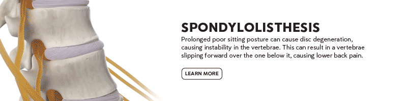 Spondylolisthesis - Learn More CTA
