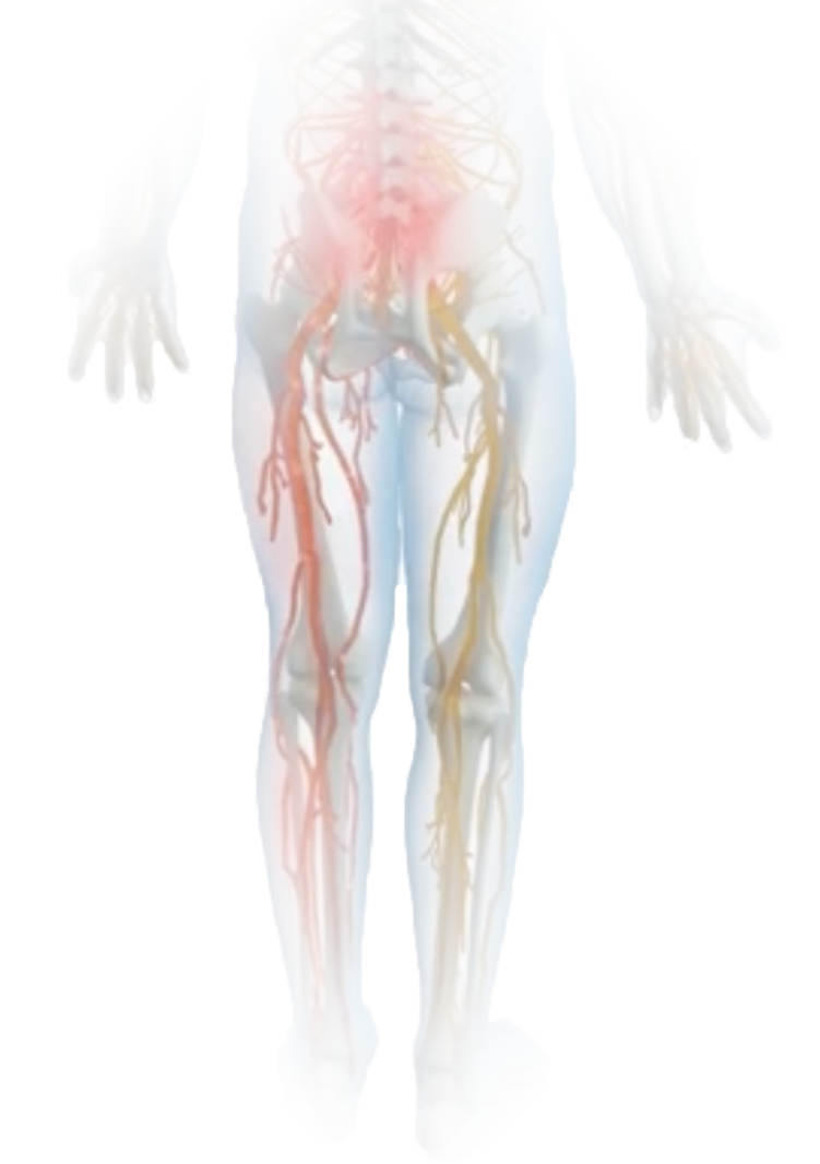GeneralLegPain