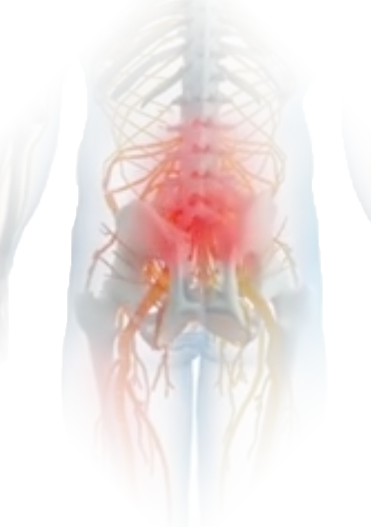GeneralLowBackPain