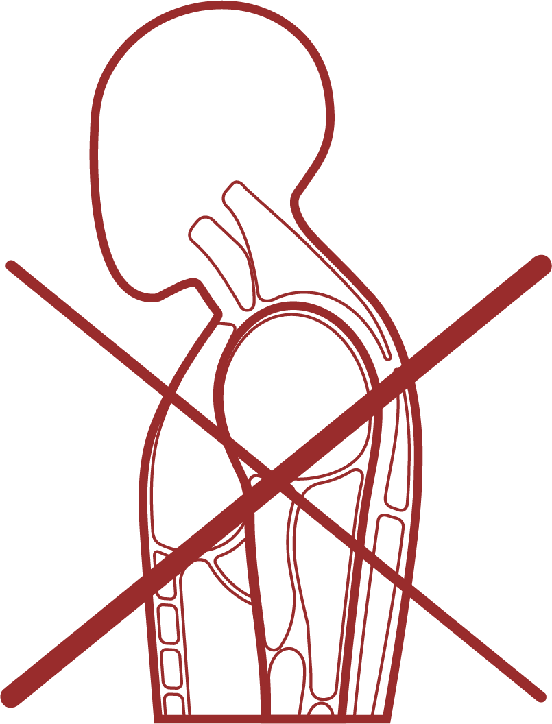 MuscleImbalance-1