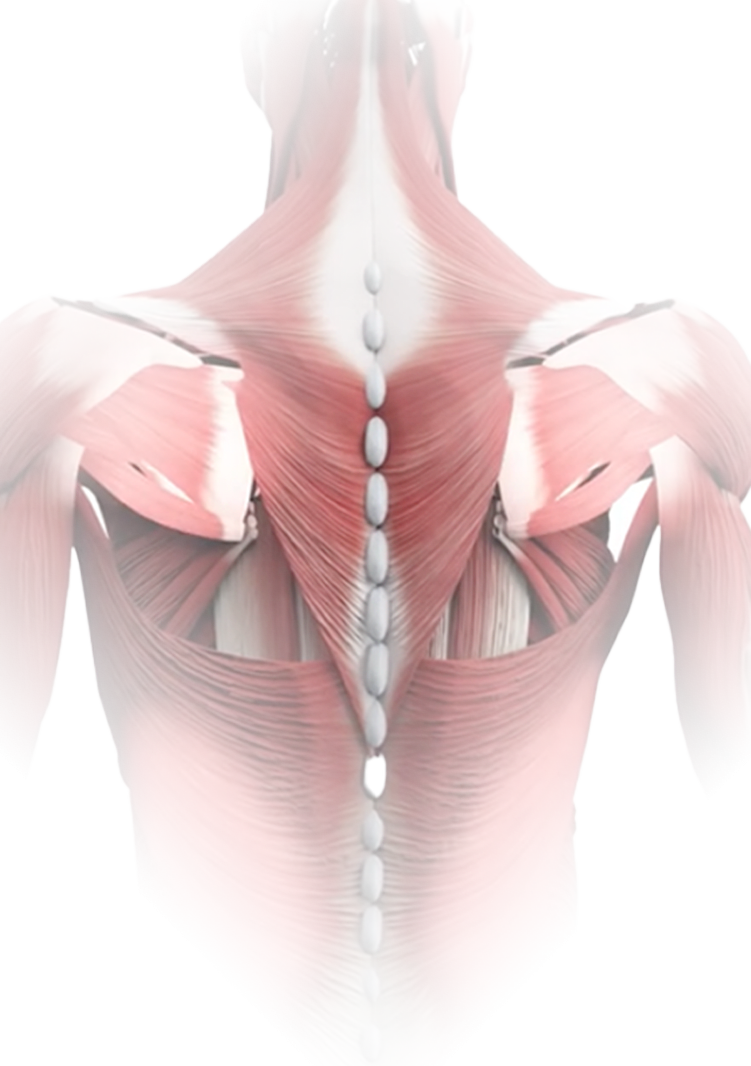 MuscleStrain