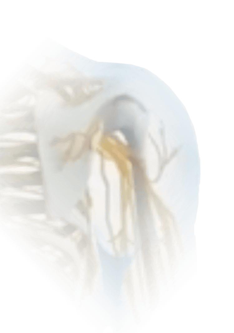ShoulderPain