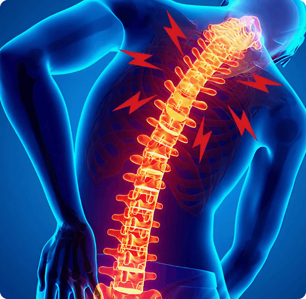 Upper-Back-Pain