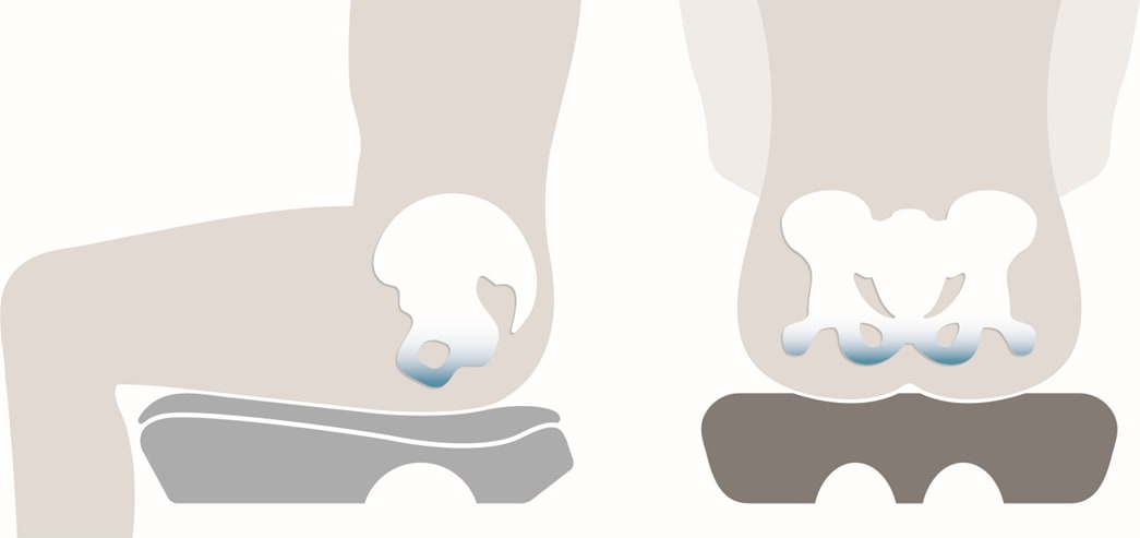 Preview image for How To Relieve Buttock Pain In Sitting