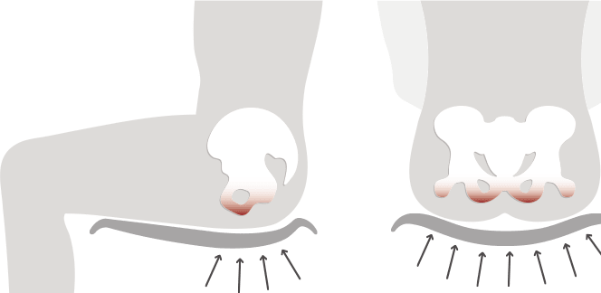 bd6