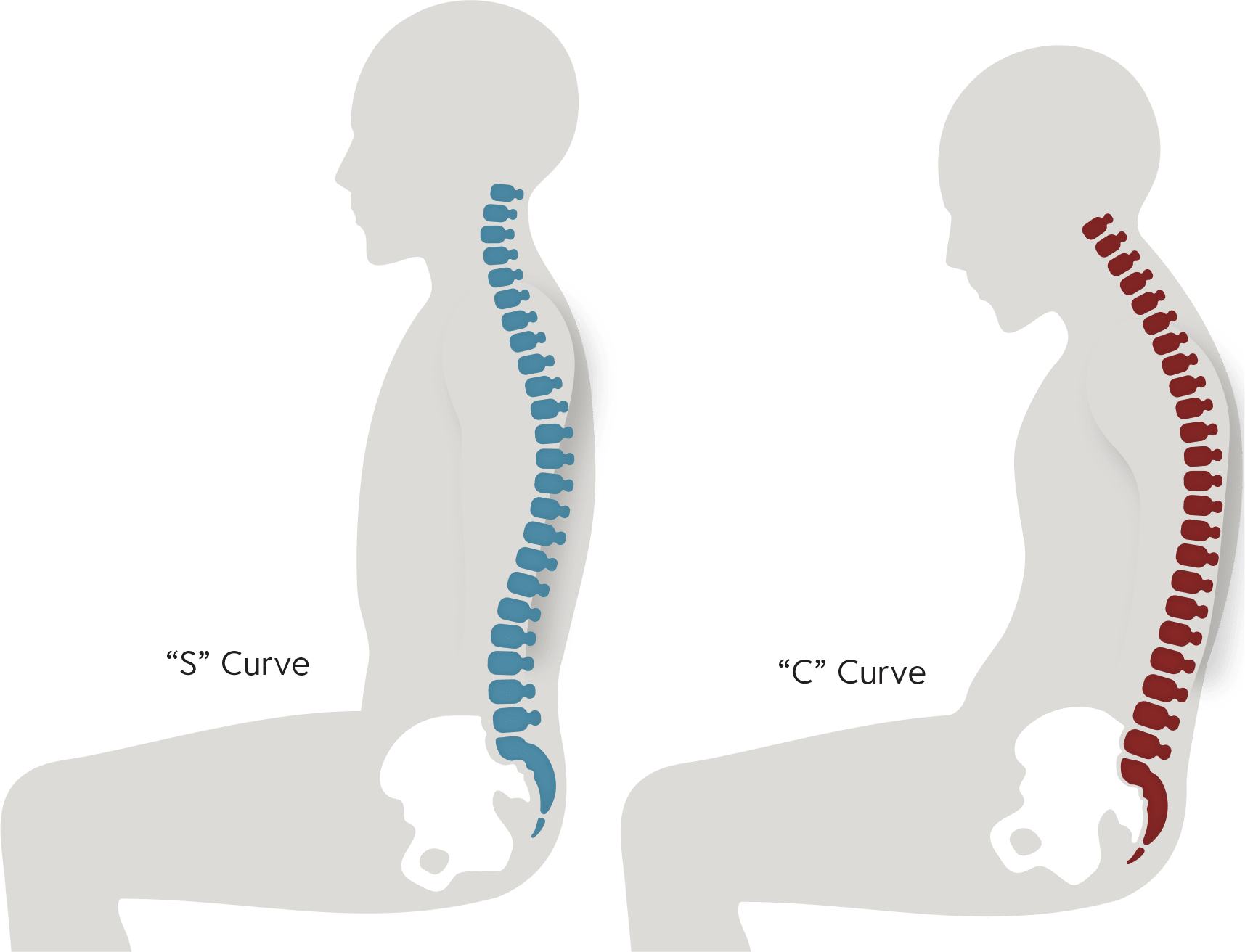 curved-spine-in-seated-position