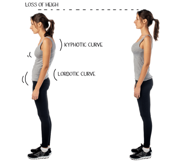 two-girls-posture