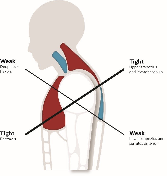 Preview image for How To Stop Slouching! Easily Improve Your Posture