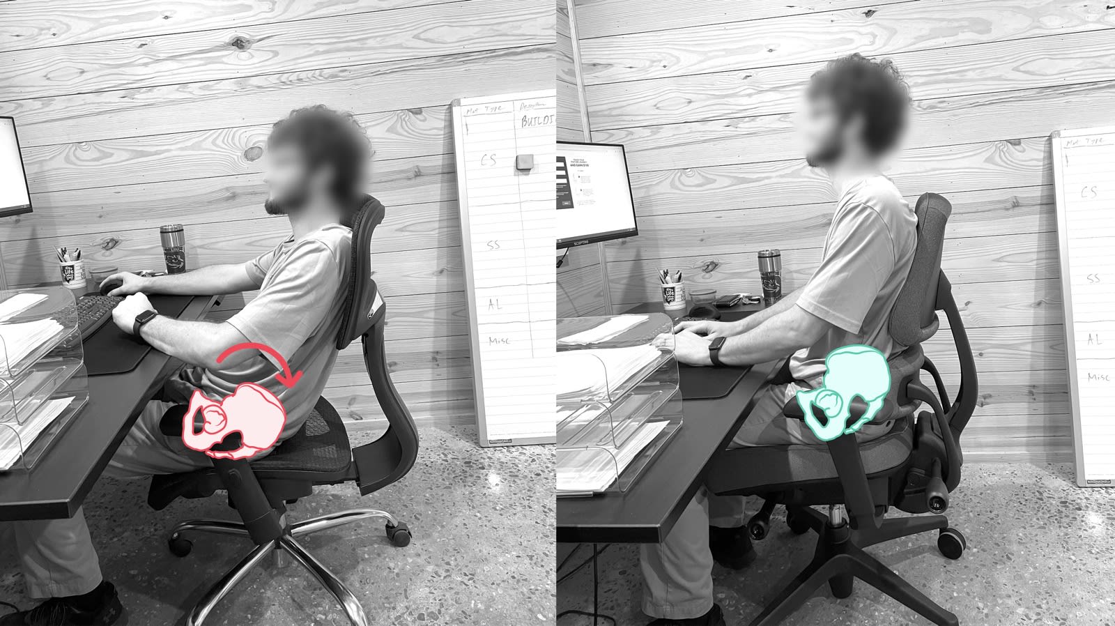 Before and after posture comparison: pelvis rotated back and unsupported on the left, pelvis upright and supported by the Anthros chair on the right