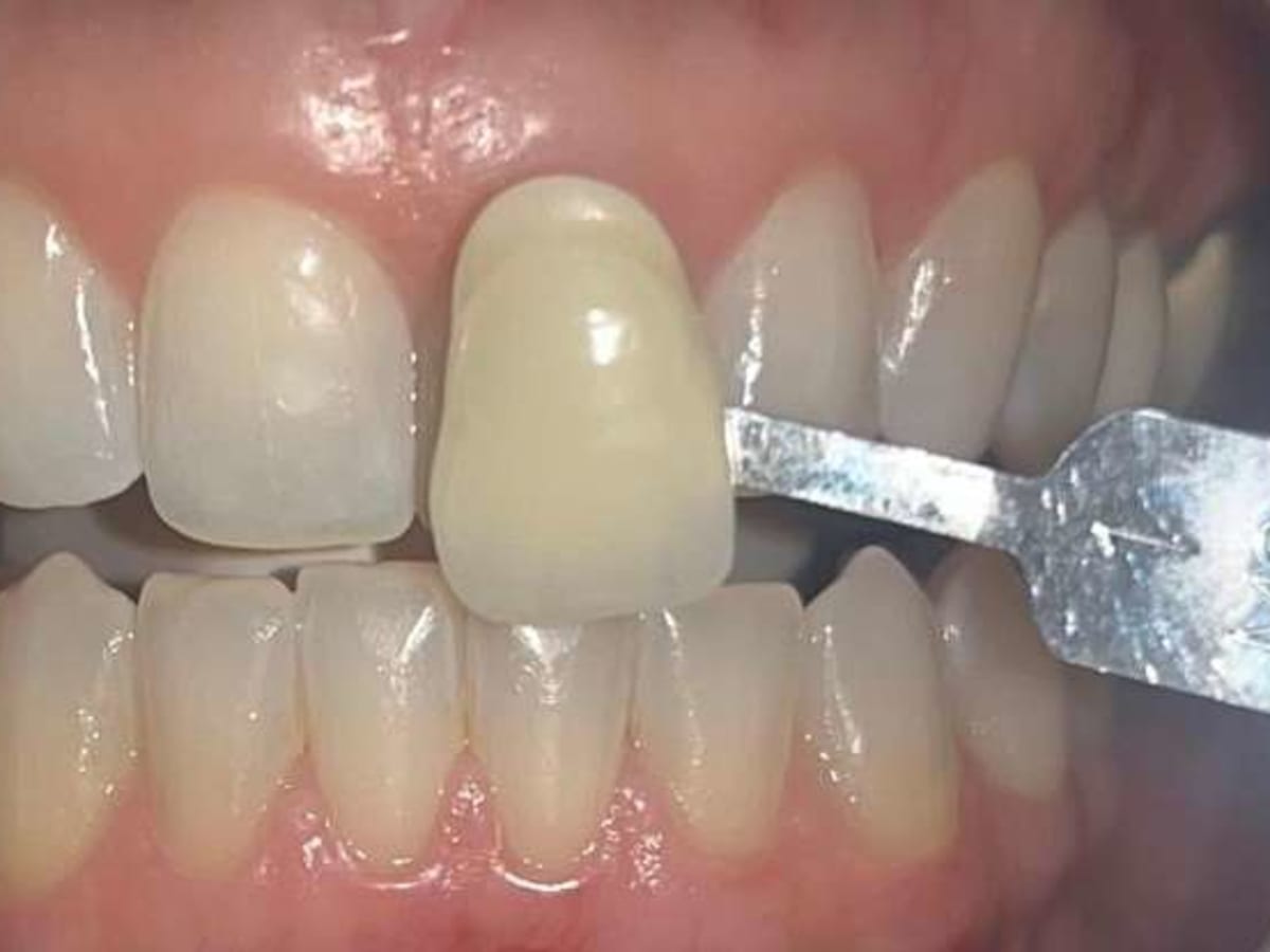 Signature Smiles cover