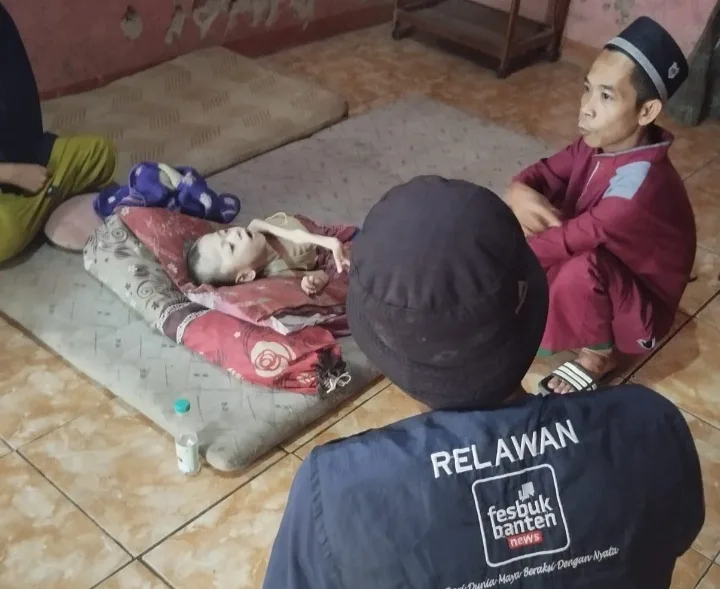 Anak Gizi Buruk di Pandeglang Memprihatinkan