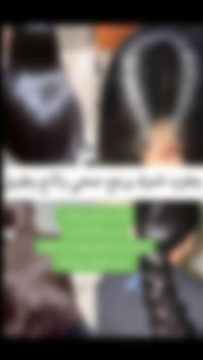 منتجات لا حل مشكلة تساقط الشعر 