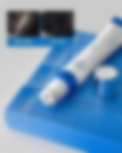 امباله تحفيز فروة الراس
