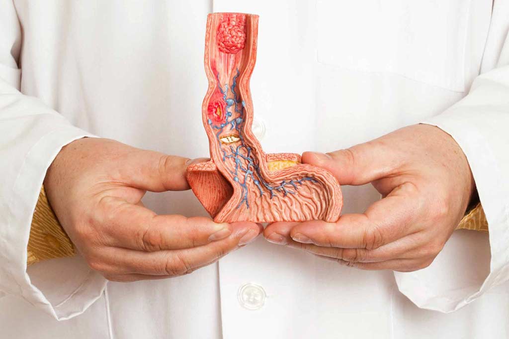 Malaltia de Peyronie: símptomes, causes i opcions de tractament no quirúrgic