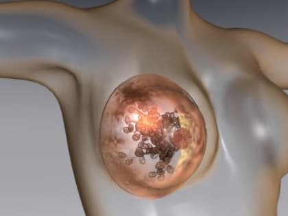 Береги грудь с молоду