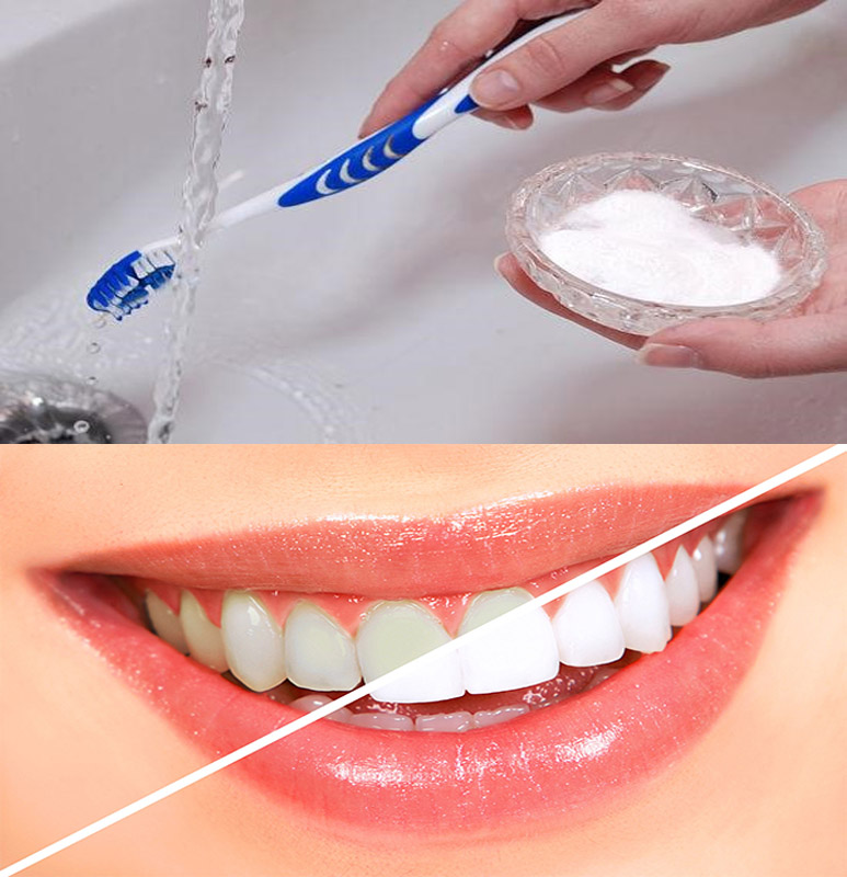 20 Cách làm trắng răng nhanh nhất an toàn hiệu quả tại nhà