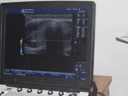 Найти и обезвредить: «Онкопатруль» в Невинномысске помогает вовремя диагностировать различные виды рака