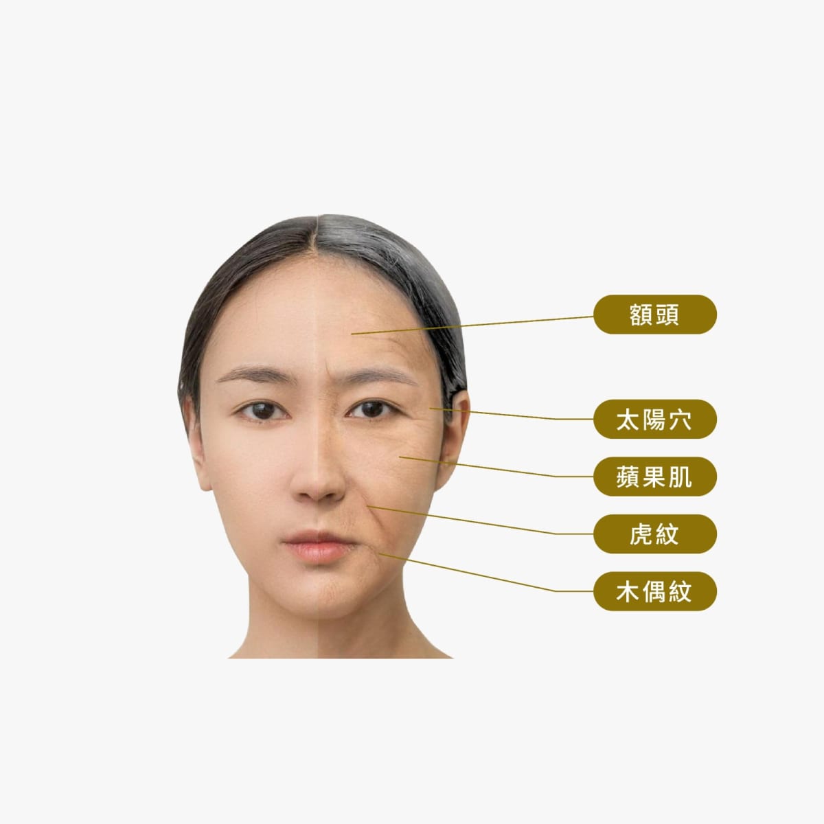 Natural B膠原少女針 膠原自生 水潤自然 | Bora Beauty