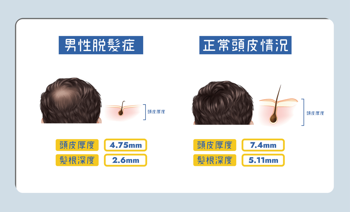 Bora Beauty防脫育髮護理