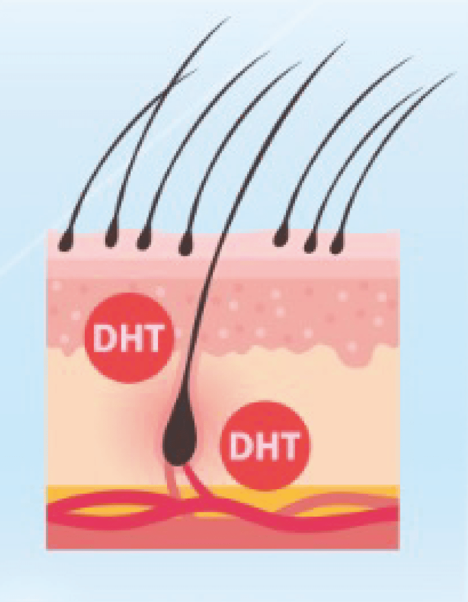 DHT影響細胞