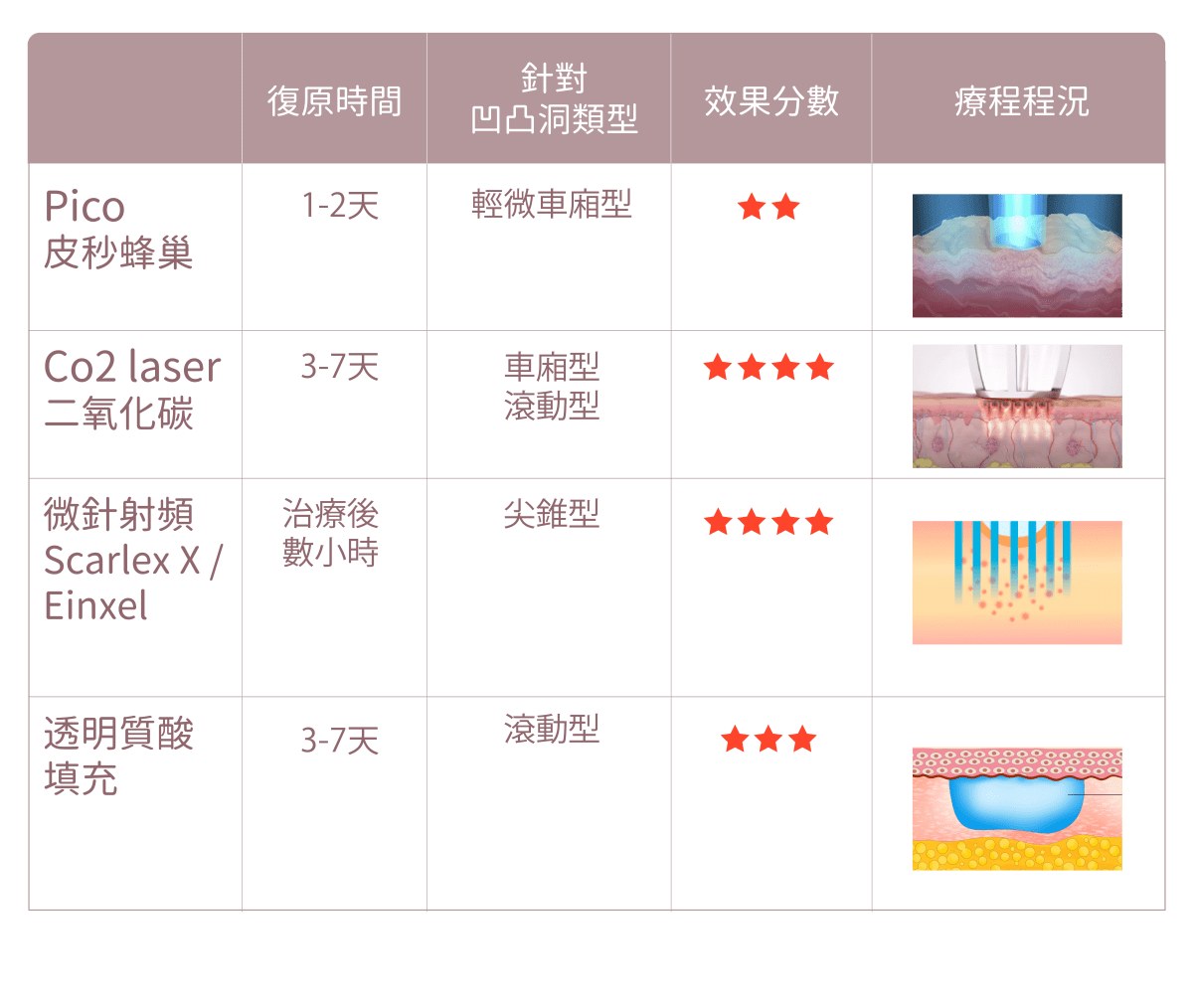 凹凸洞治療方法比較