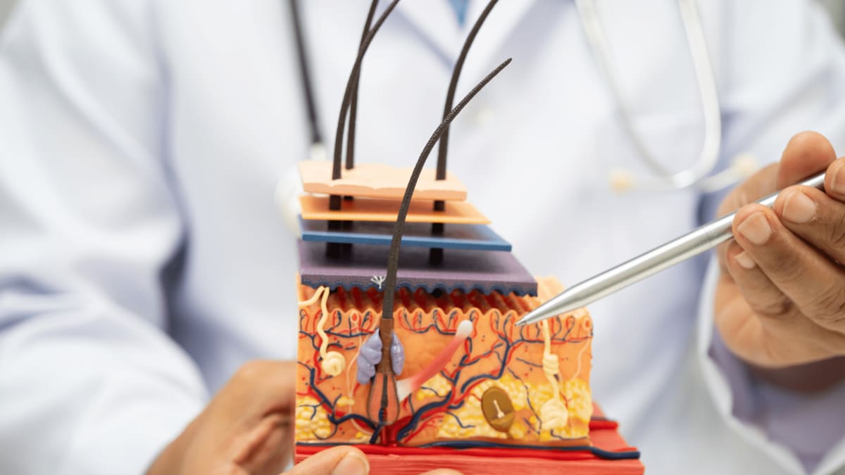 生髮治療把握黃金期 激活毛囊再生