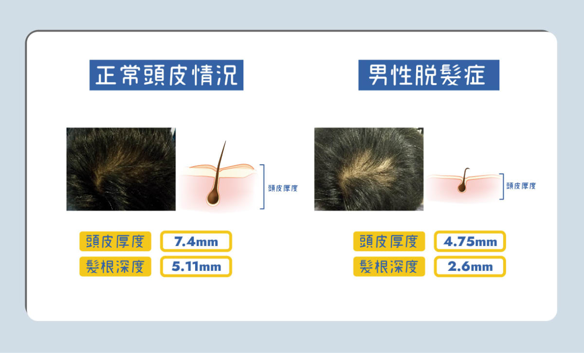 Bora Beauty防脫育髮護理