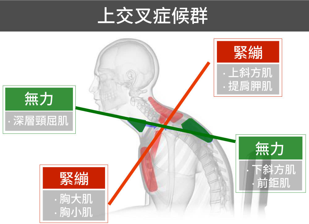 頸緊膊痛原因