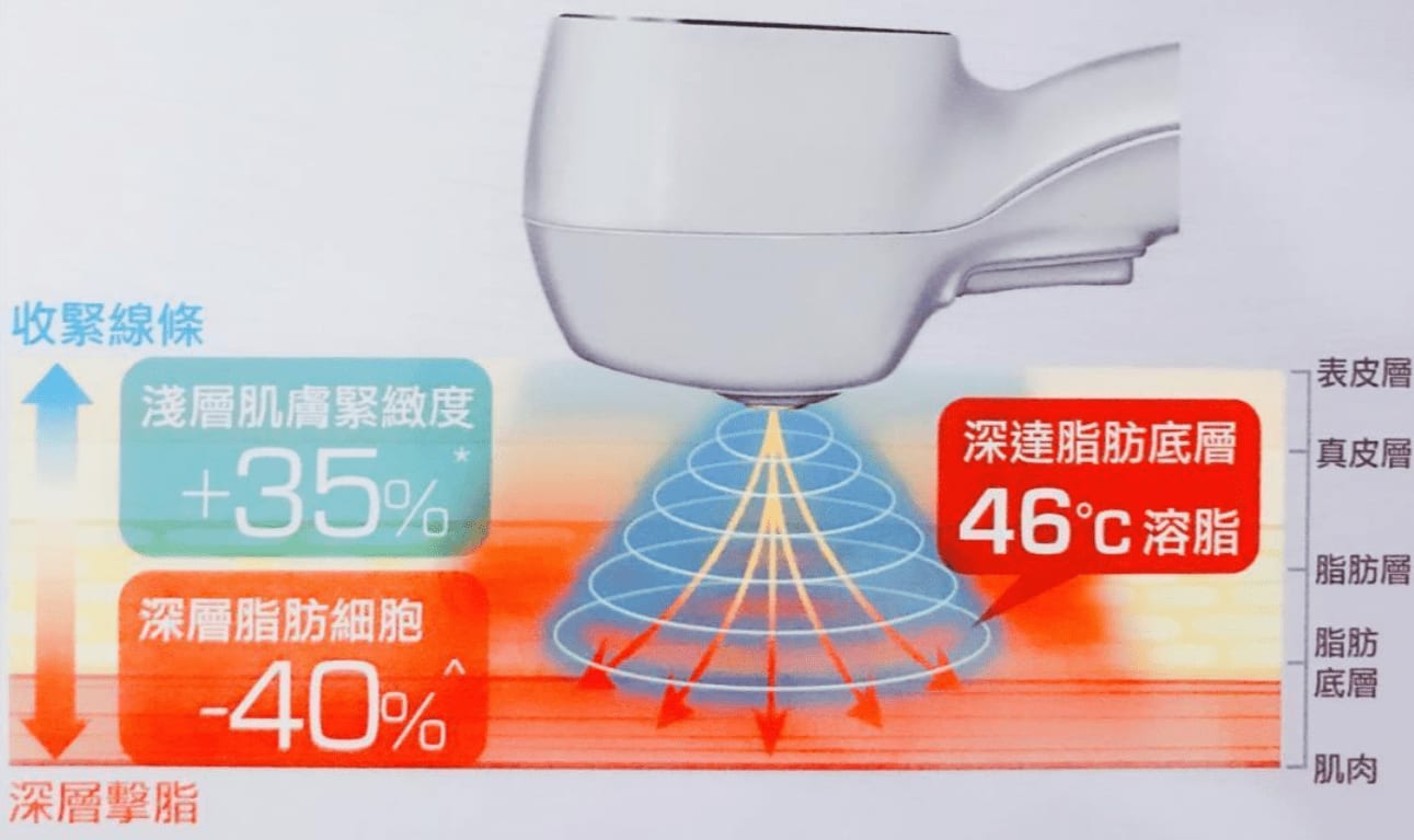 Ultra 360™ 分層能量導入技術