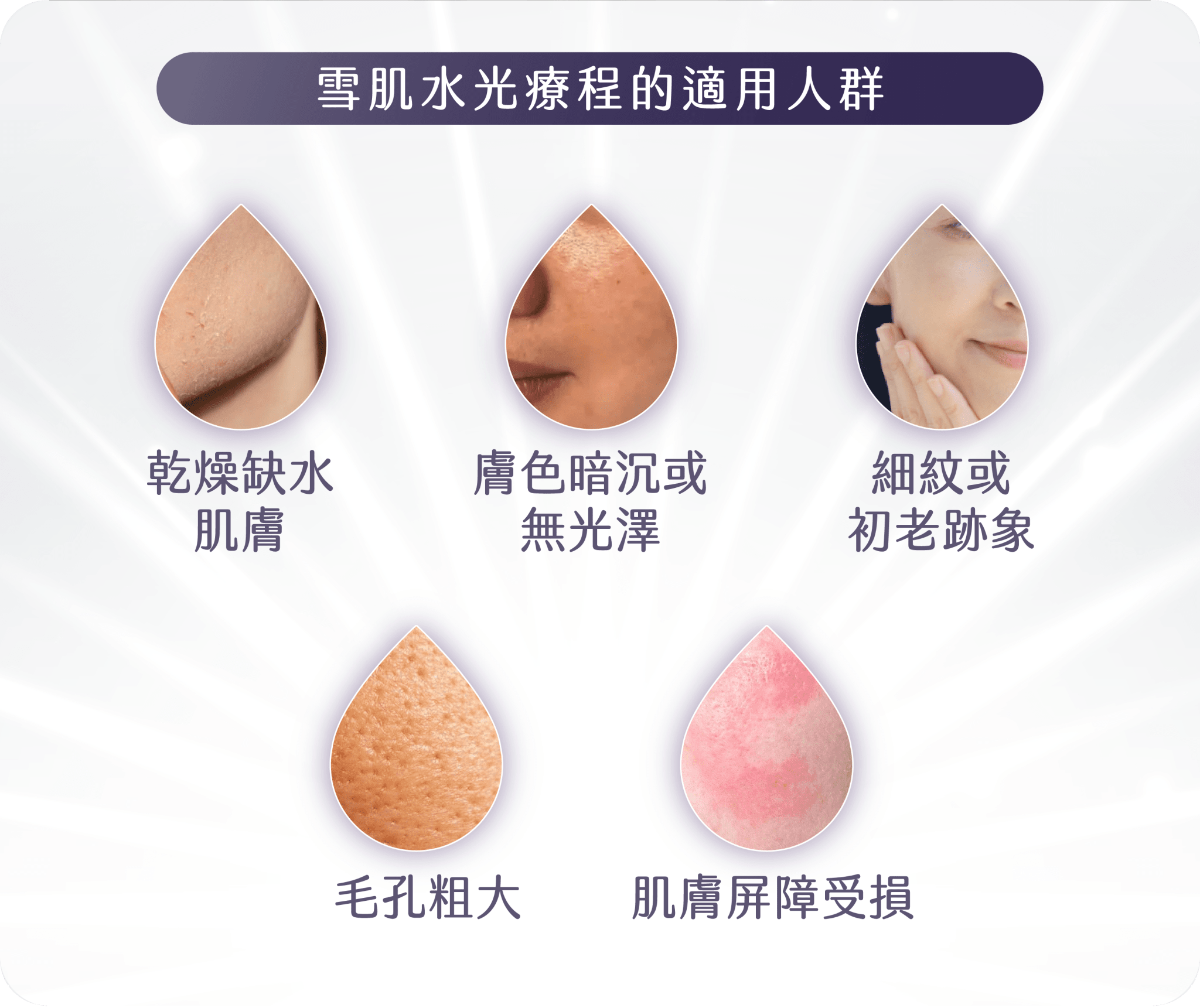 雪肌水光療程的適合人群