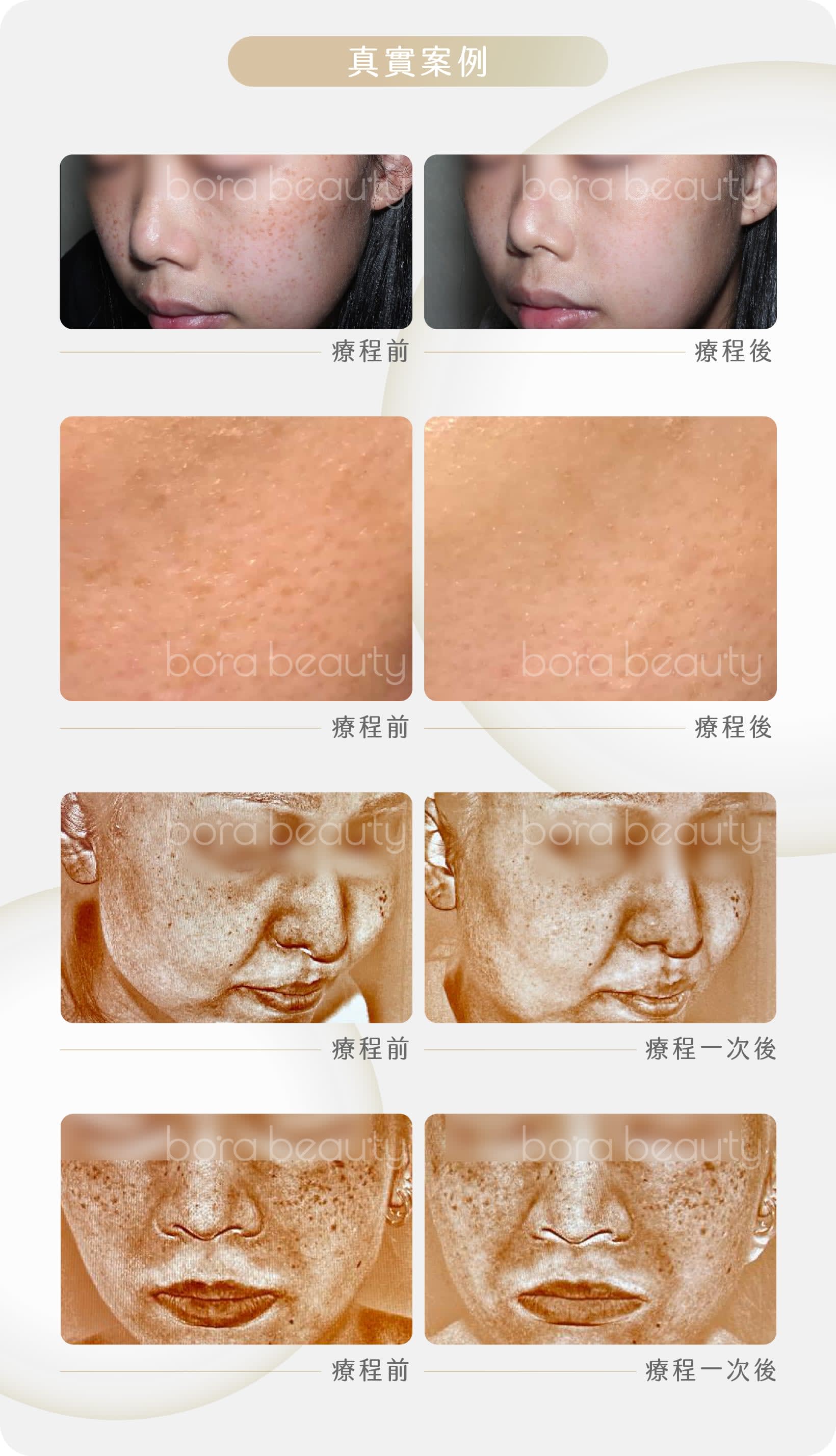 真實案例