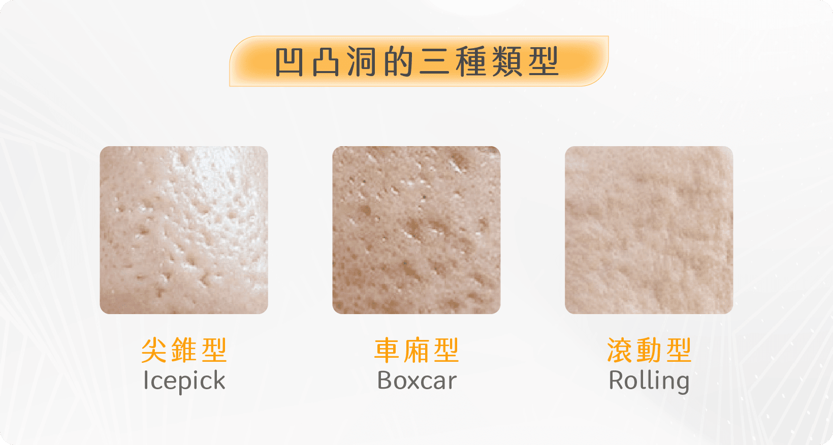凹凸洞類型