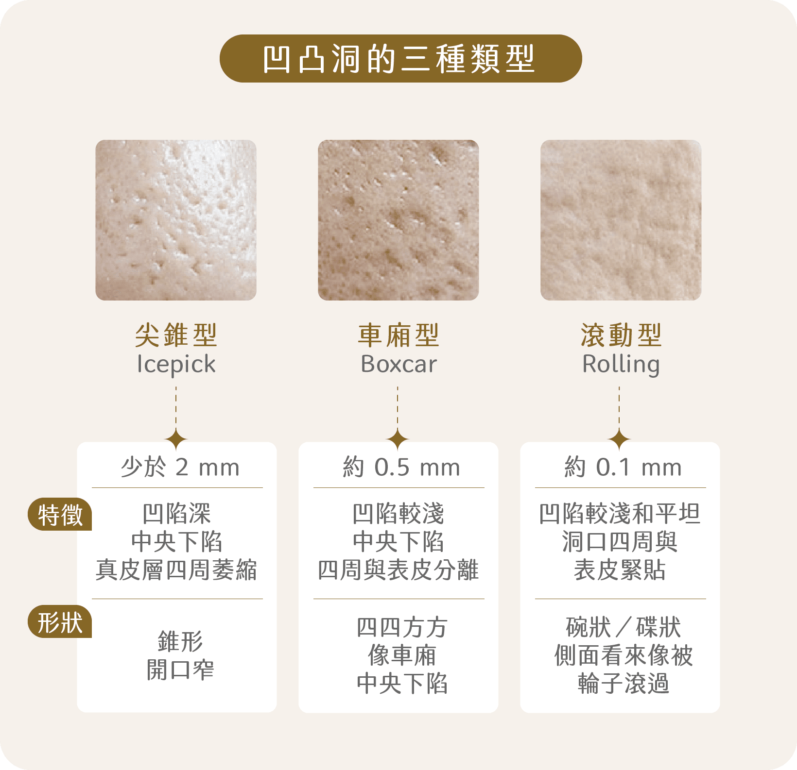 凹凸洞類型