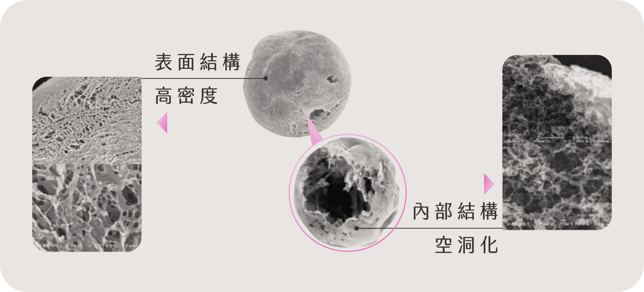 AestheFill 精靈針lihkg