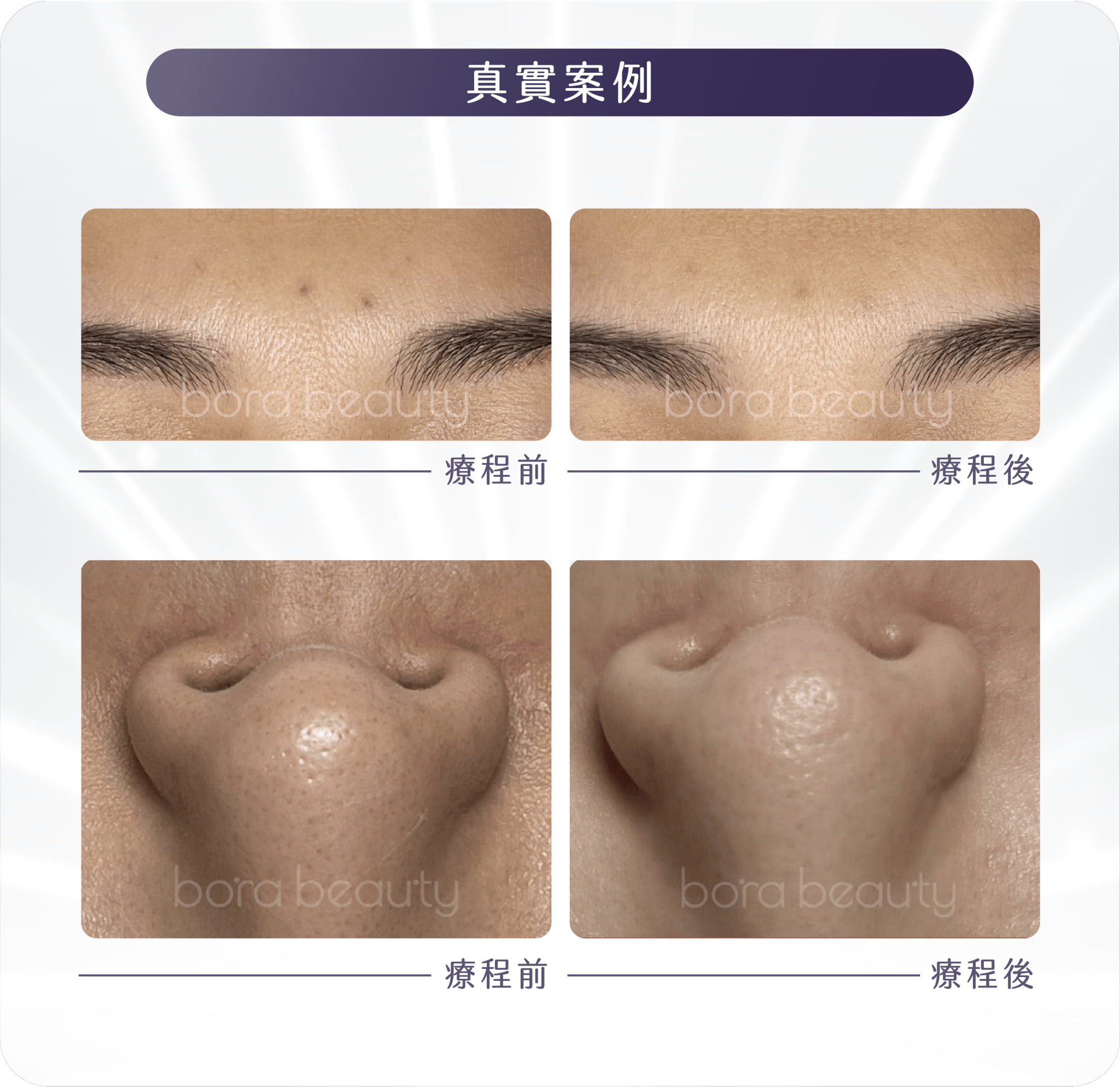 療程效果