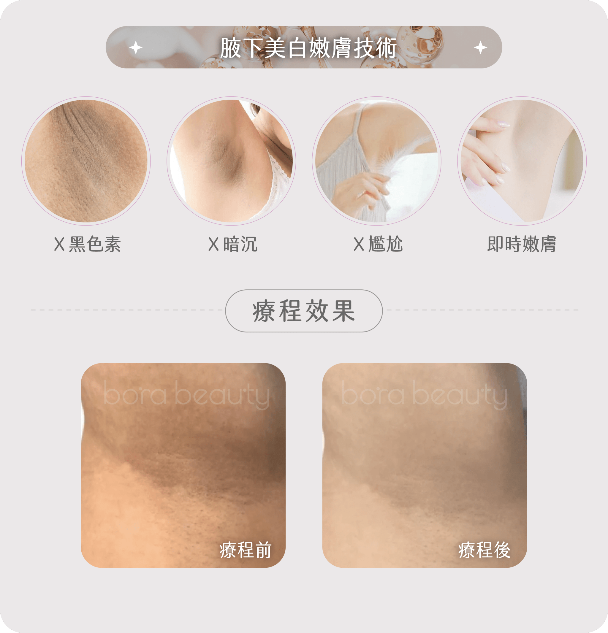  治療思路