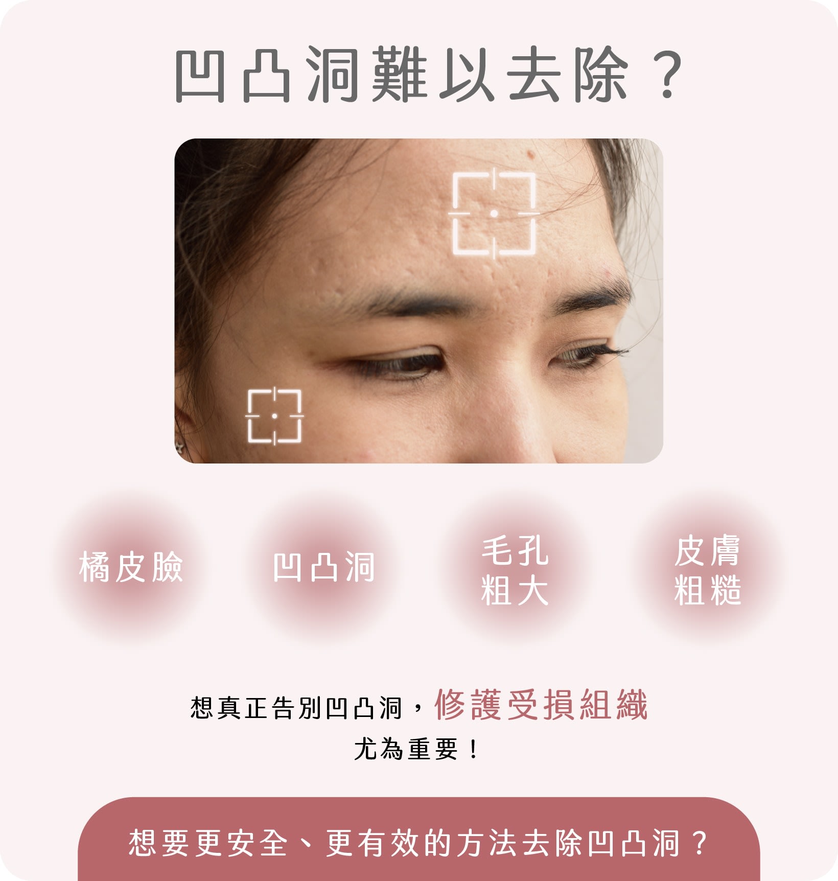 去除凹凸洞