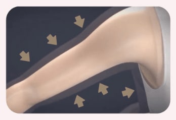瓷溫手臂拜拜肉療程