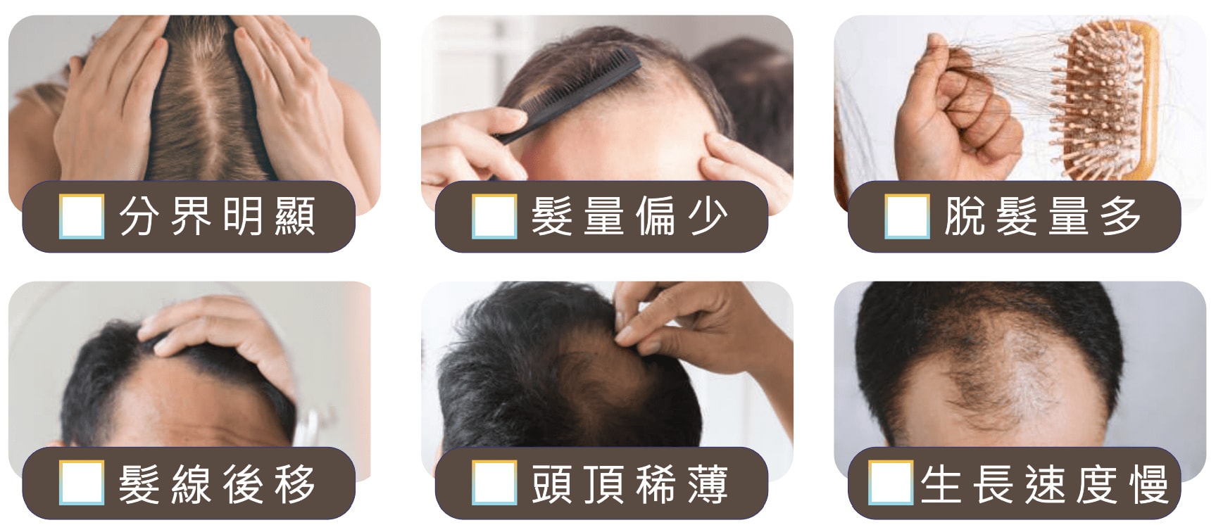 脫髮問題