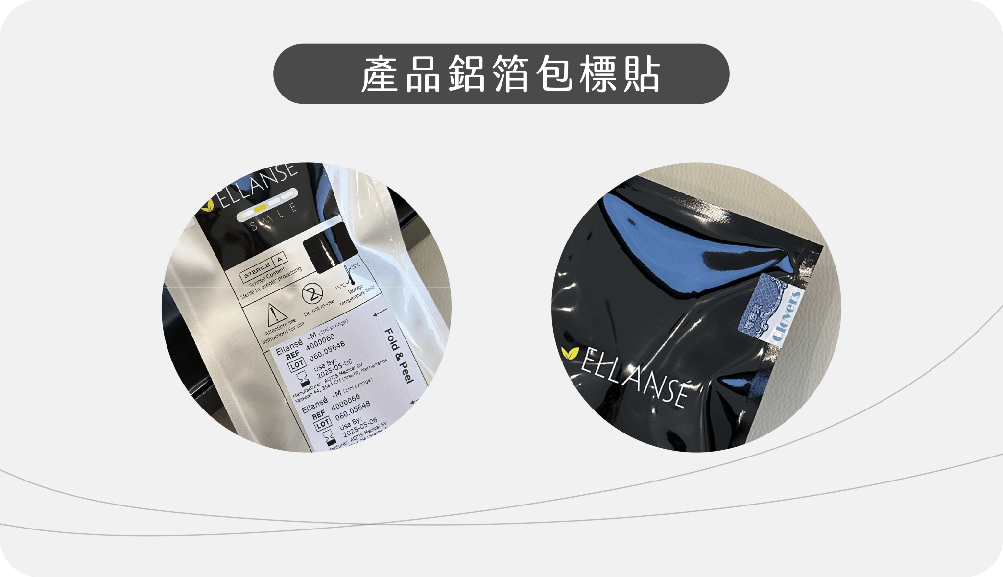 少女針Ellanse