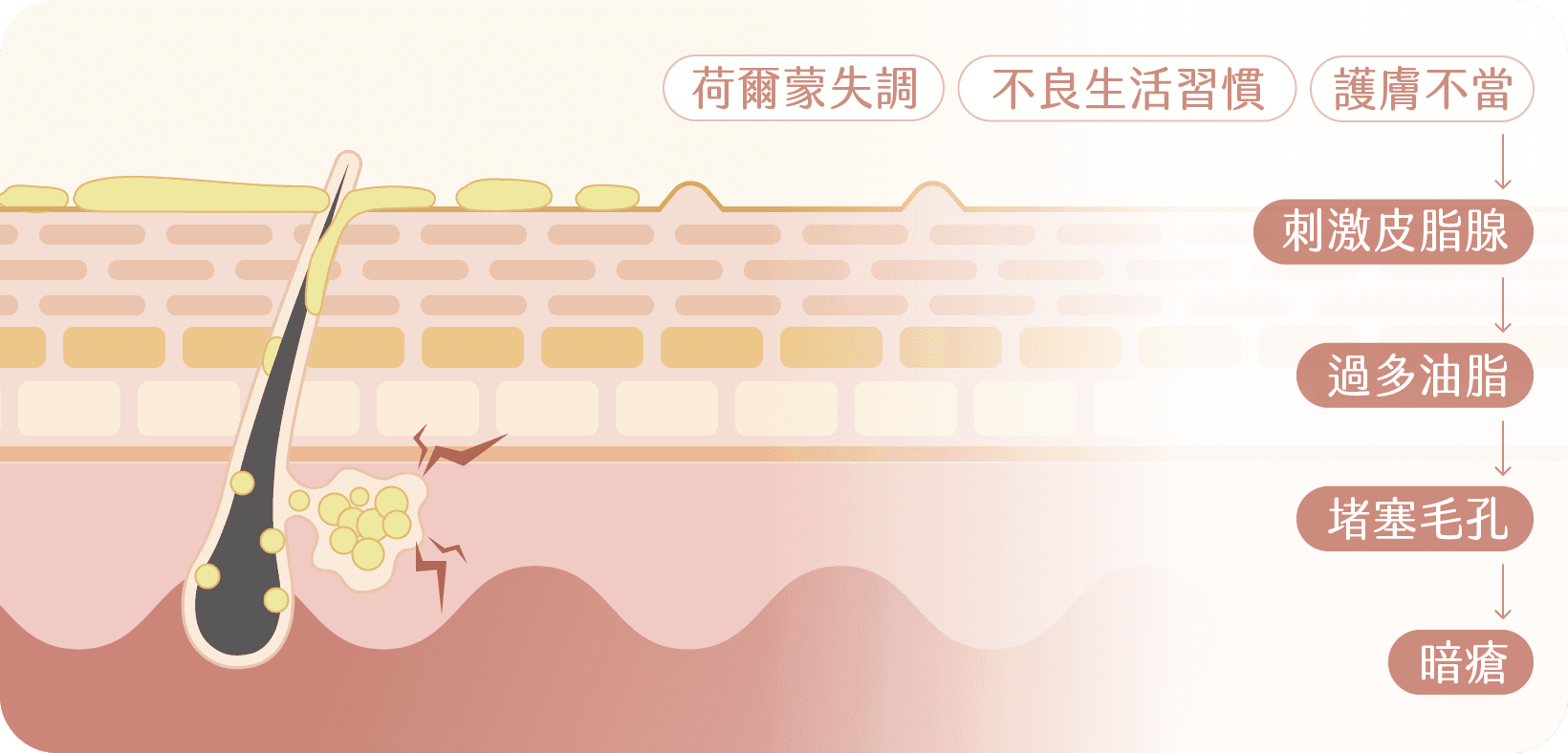 治療思路